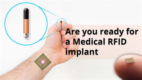 rfid chip microwave|microchip tracker for humans.